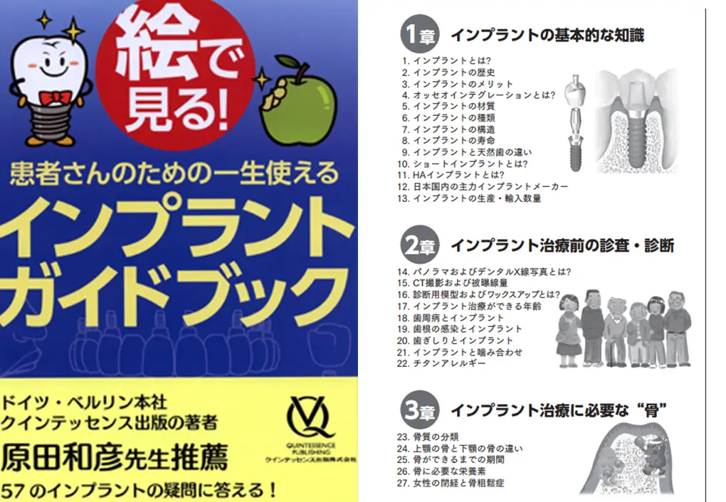 インプラントガイドブック｜等々力・深沢の歯医者 とどろき歯科・矯正歯科