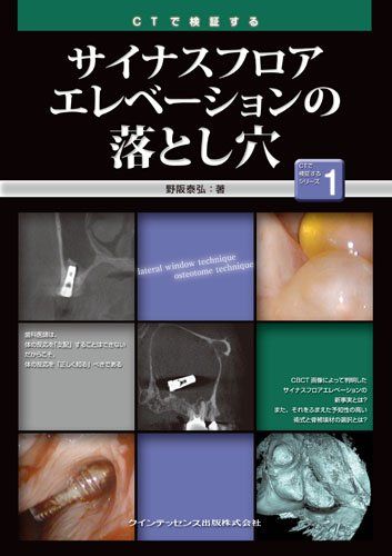 楽天市場】サイナスフロアエレベーションの通販