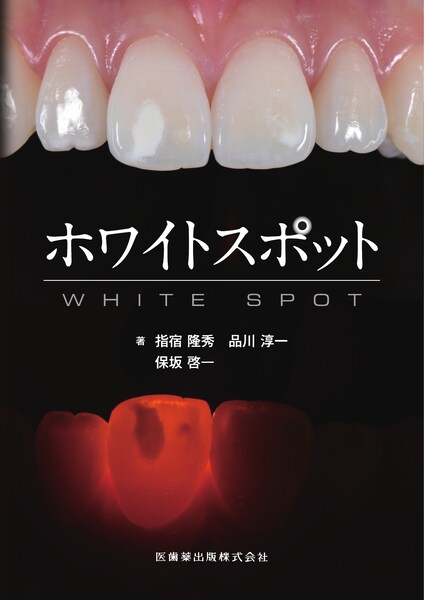 歯科国試パーフェクトマスター 口腔インプラント学／医歯薬出版株式会社