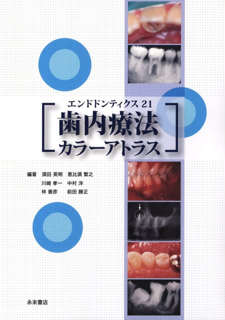 永末書店 歯内療法カラーアトラス