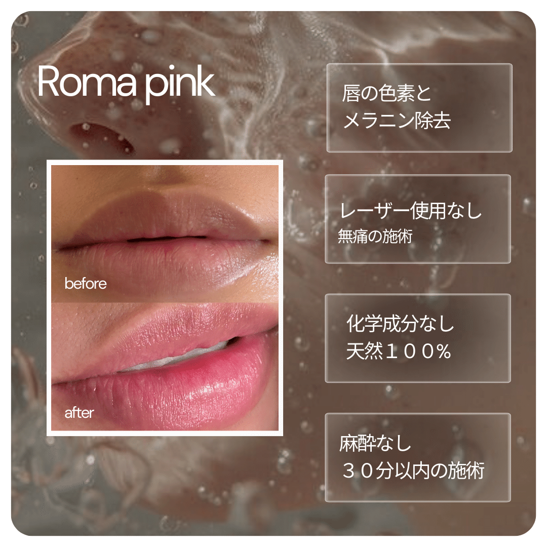 ローマピンクという新技術！！｜shu-salon