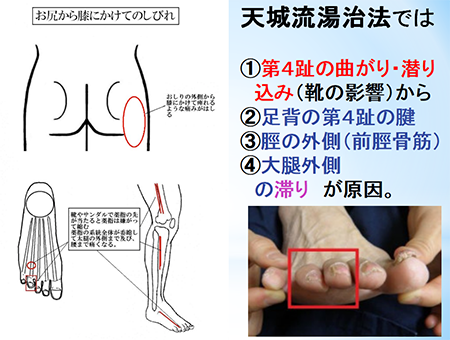 天城流医学大全集＜症状別腰痛編＞