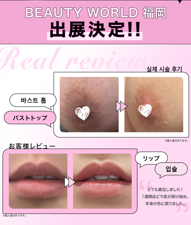 ローマピンク