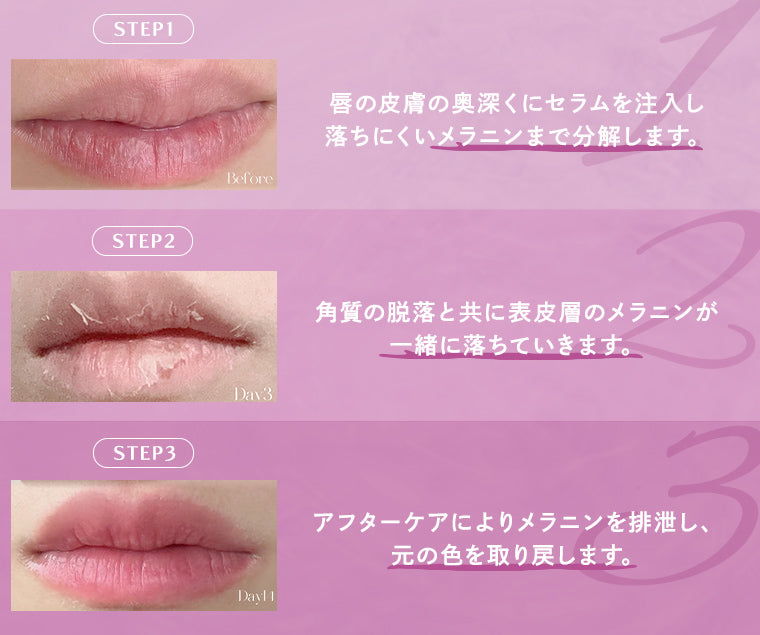 ローマピンク