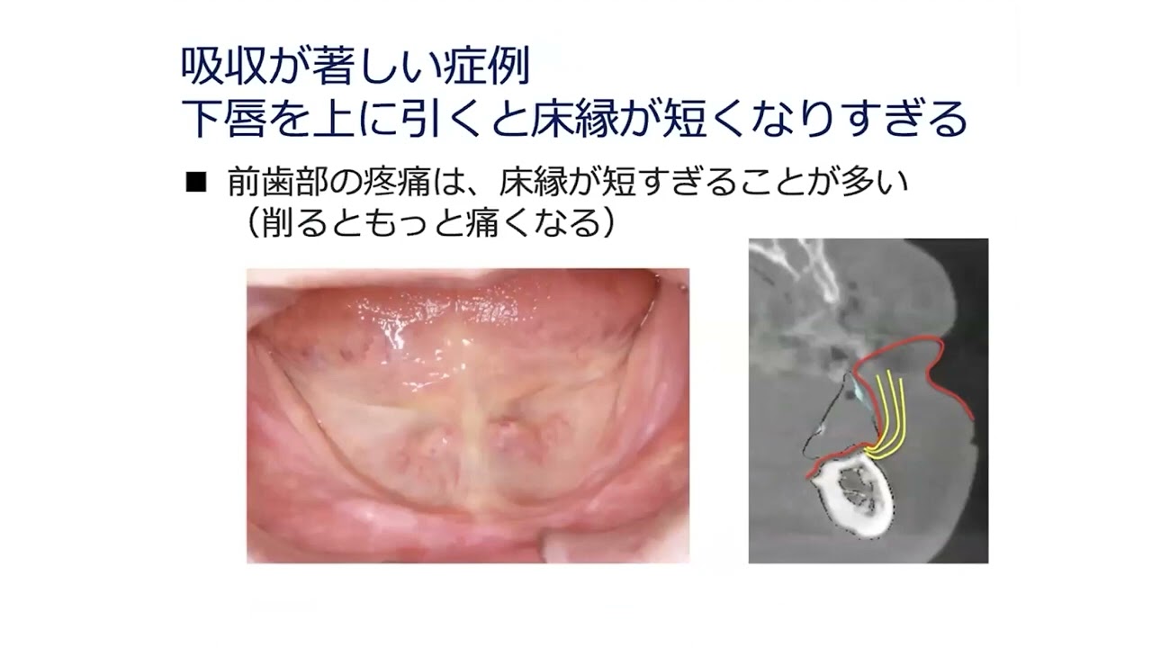 訪問診療と全部床義歯 – 株式会社デジタルクリエイト・オンラインショップ