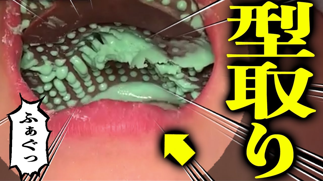 Children's Orthodontics Prevention Teeth Alignment Health - YouTube