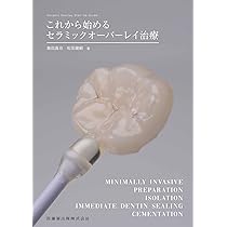 The Tooth Preparation: 補綴修復治療の成功を目指した支台歯形成