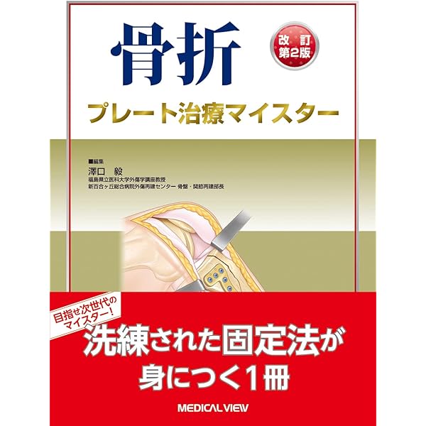 Amazon.co.jp: 骨折の術前計画55: 7000例から厳選 : 矢倉 拓磨