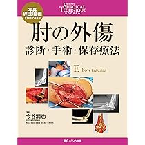 骨折治療 手術アプローチがよくわかる髄内釘・プレート固定 | 渡部 欣