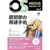 股関節の再建手術［Web動画付］ (新OS NEXUS No.8) | 松田 秀一 |本