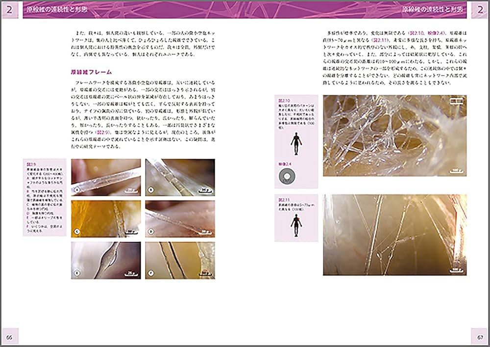 人の生きた筋膜の構造(DVD付き) 内視鏡検査を通して示される細胞外