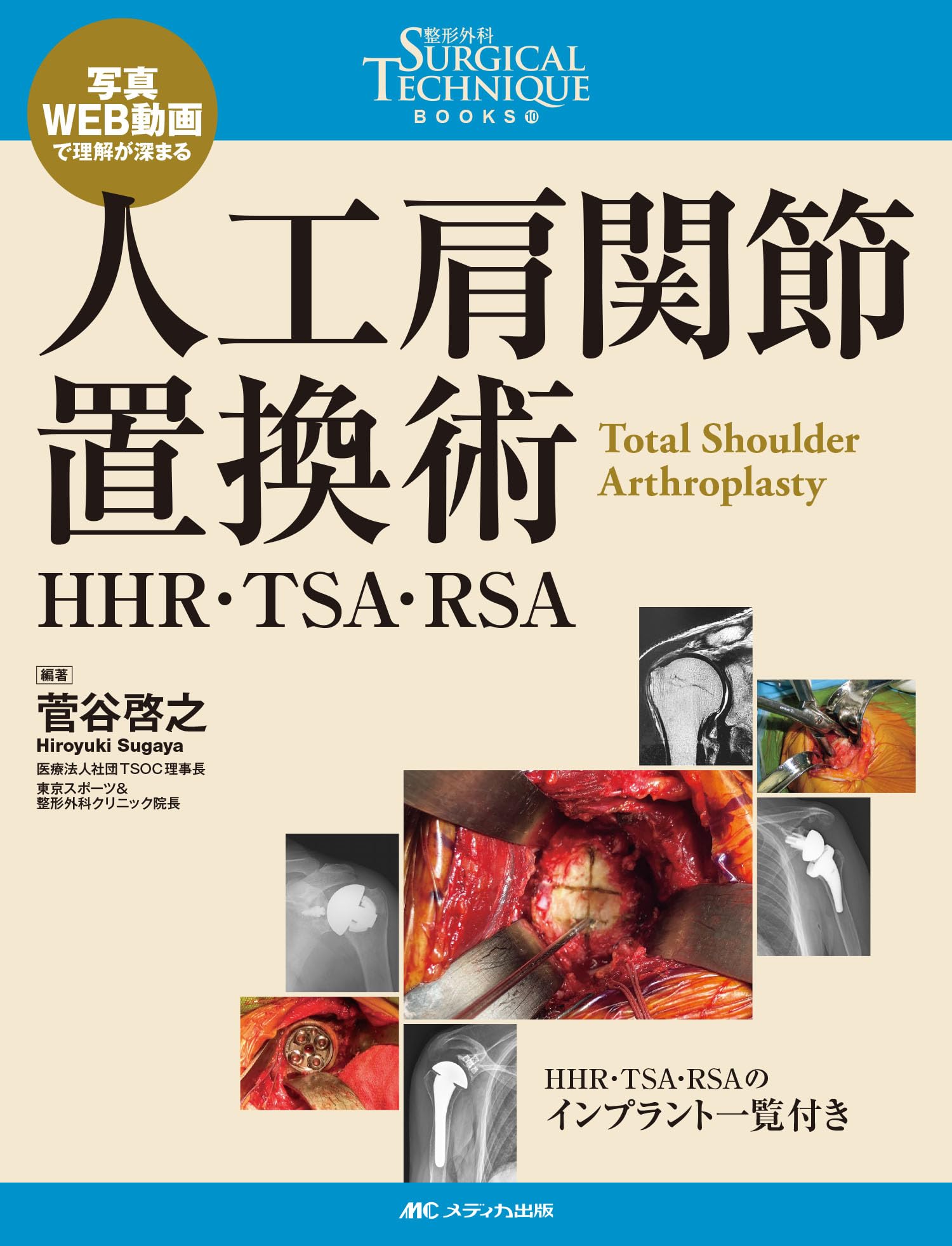 人工肩関節置換術: HHR・TSA・RSA (整形外科SURGICAL TECHNIQUE BOOKS