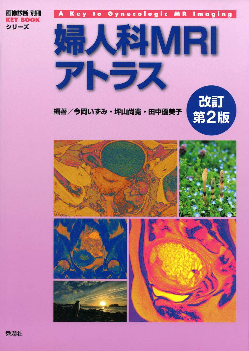 婦人科MRIアトラス 改訂第2版 (画像診断 別冊KEYBOOKシリーズ) | 今岡