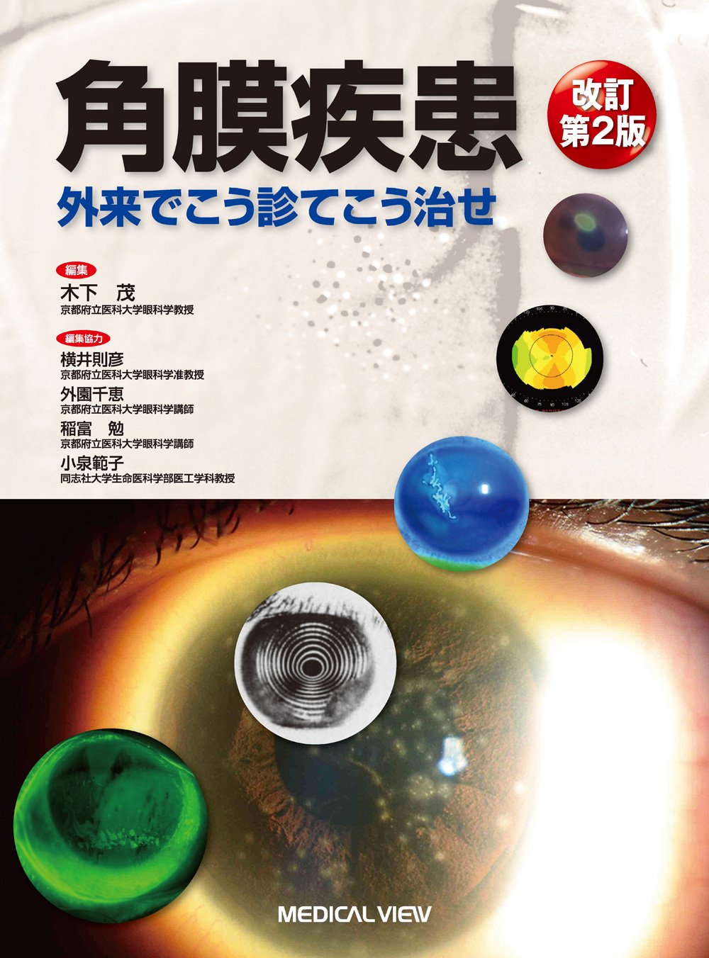 角膜疾患−外来でこう診てこう治せ | 木下 茂 |本 | 通販 | Amazon