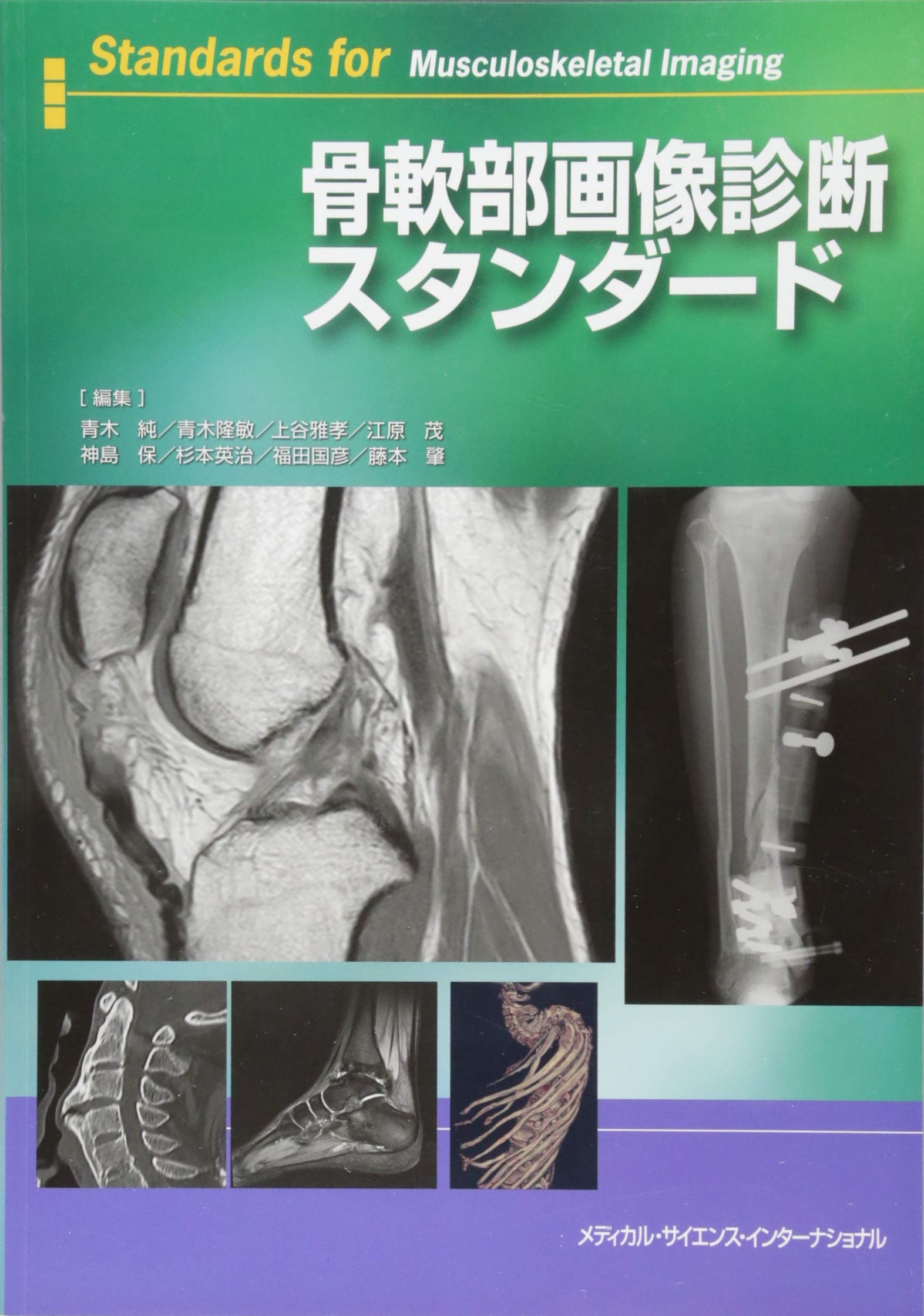 骨軟部画像診断スタンダード | 青木純, 青木隆敏, 上谷雅孝, 江原茂