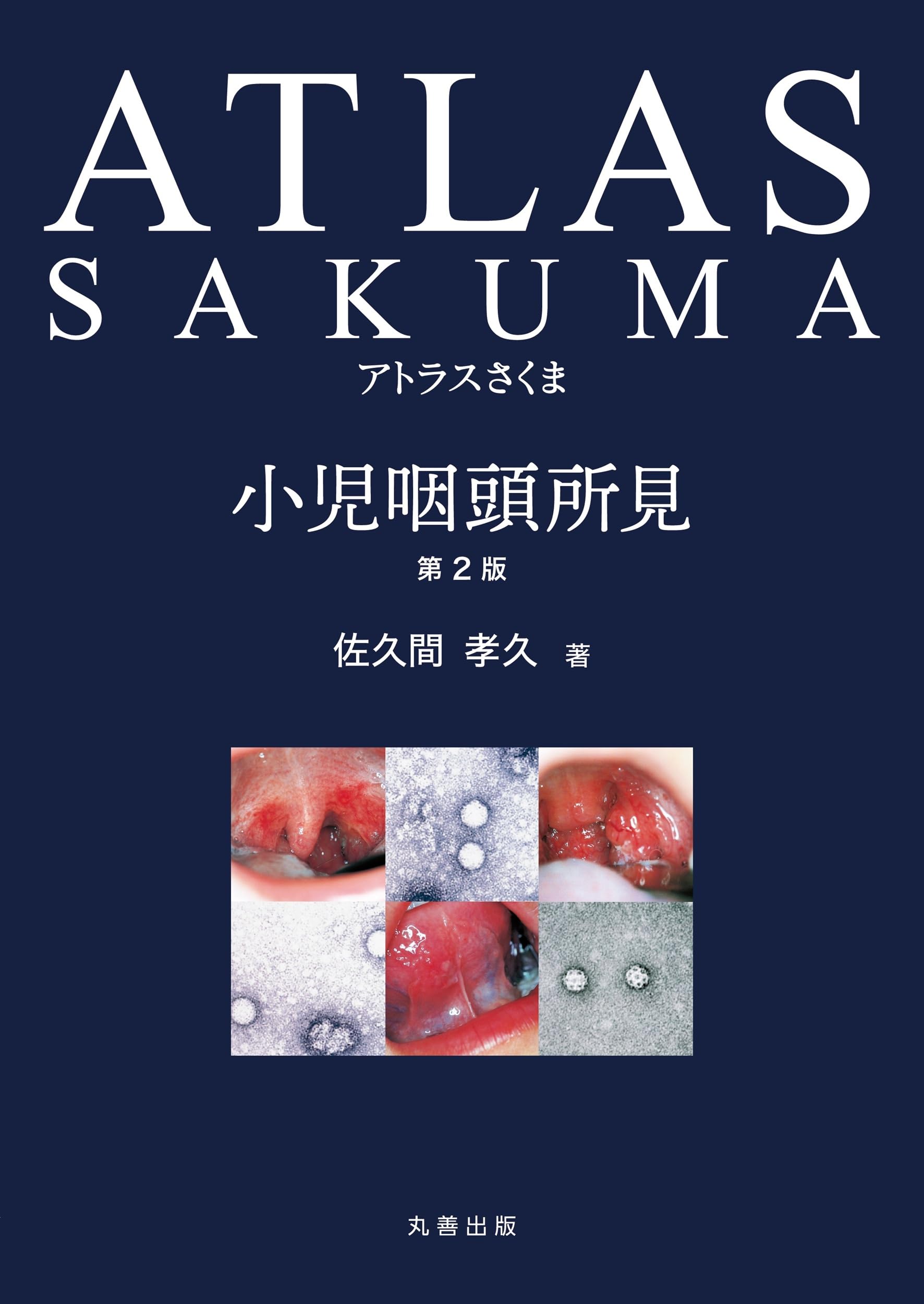 Amazon.co.jp: アトラスさくま 小児咽頭所見 第2版 : 佐久間 孝久: 本