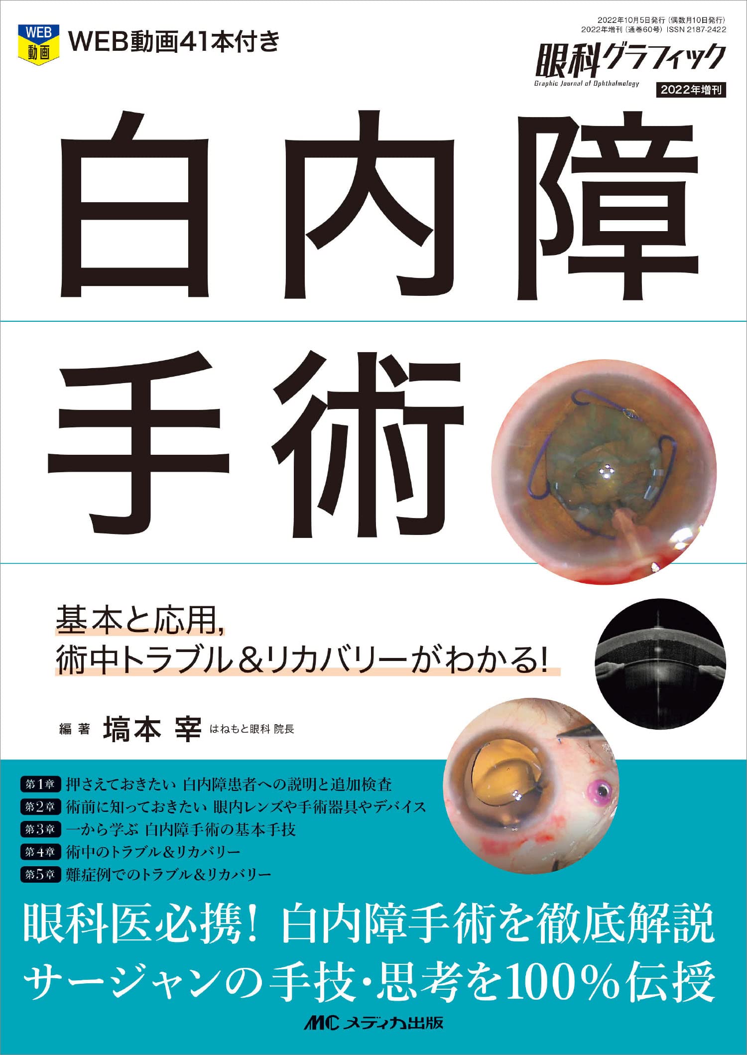 白内障手術: 基本と応用，術中トラブル＆リカバリーがわかる！ (眼科