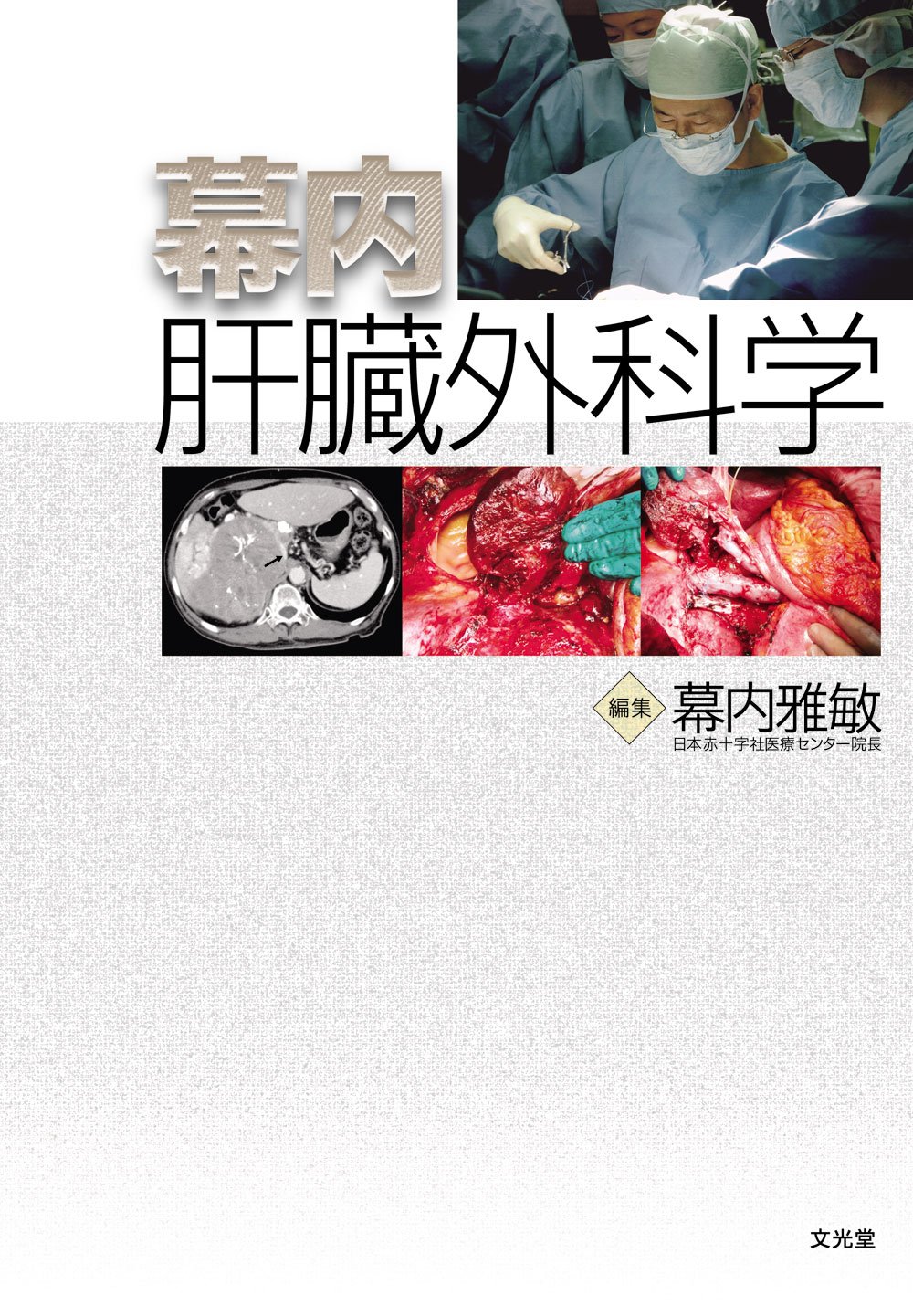 Amazon.co.jp: 幕内肝臓外科学 : 幕内 雅敏: Japanese Books