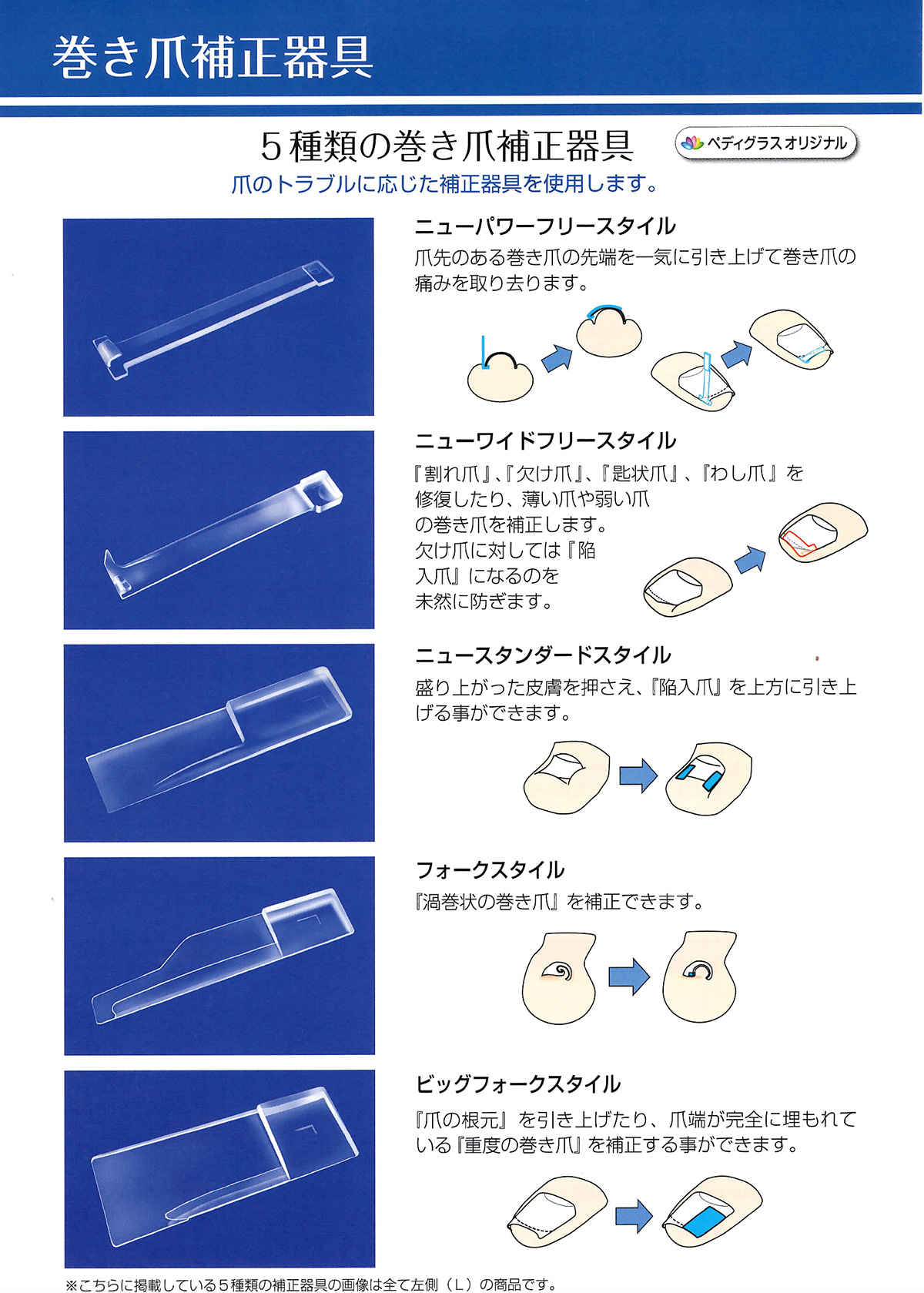 巻き爪補正スクール ペディグラス宇都宮